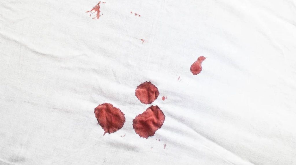 Guía completa para quitar manchas de sangre de las sábanas 1 Manchas de sangre sábana blanca
