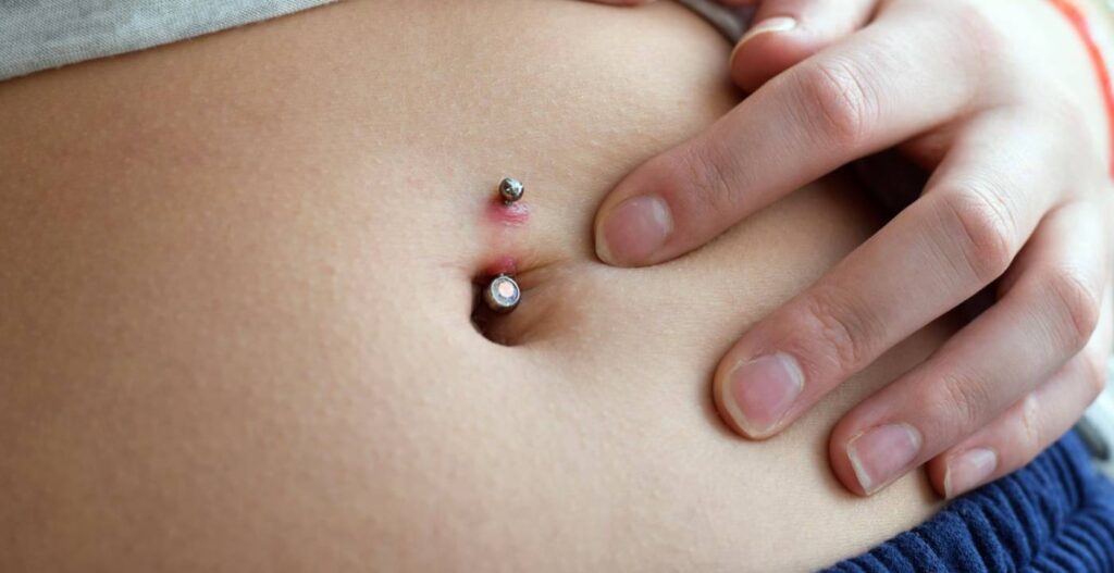 desinfectar un piercing en el ombligo